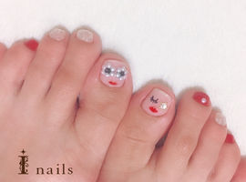 my footnail